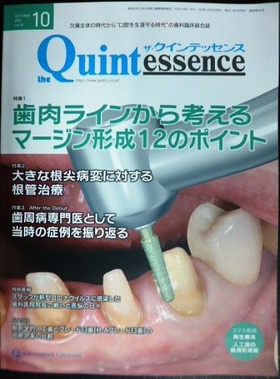 画像1: the Quintessence クインテッセンス 2020年10月号★歯肉ラインから考えるマージン形成12のポイント