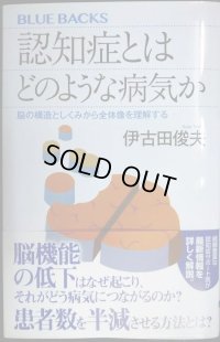 認知症とはどのような病気か 脳の構造としくみから全体像を理解する★伊古田俊夫★ブルーバックス