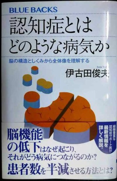画像1: 認知症とはどのような病気か 脳の構造としくみから全体像を理解する★伊古田俊夫★ブルーバックス