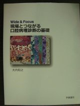 画像: Wide & Focus 現場とつながる口腔病理診断の基礎★大内知之