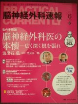 画像: 脳神経外科速報 2017年6月号★脳神経外科医の本懐