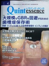 画像: the Quintessence クインテッセンス 2021年4月号★大規模なGBRを回避するための歯槽堤保存術