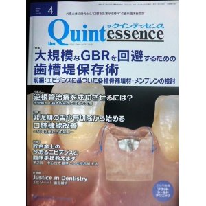 画像: the Quintessence クインテッセンス 2021年4月号★大規模なGBRを回避するための歯槽堤保存術