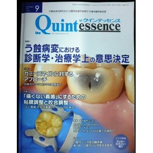 画像: the Quintessence クインテッセンス 2021年9月号★う蝕病変における診断学・治療学上の意思決定