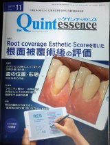 画像: the Quintessence クインテッセンス 2021年11月号★RESを用いた根面被覆術後の評価