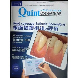 画像: the Quintessence クインテッセンス 2021年11月号★RESを用いた根面被覆術後の評価