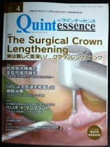 画像: the Quintessence クインテッセンス 2022年4月号★実は難しく奥深い! クラウンレングスニング