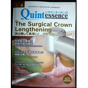 画像: the Quintessence クインテッセンス 2022年4月号★実は難しく奥深い! クラウンレングスニング